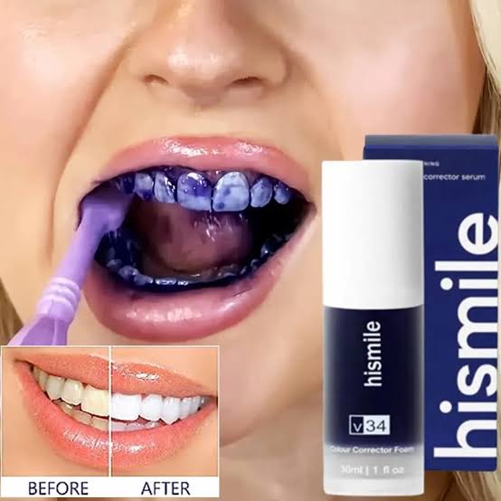 Hismile V34 Teeth Whitening Toothpaste
