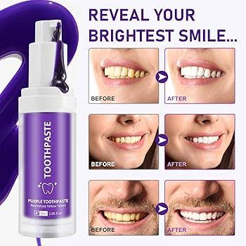 Hismile V34 Teeth Whitening Toothpaste