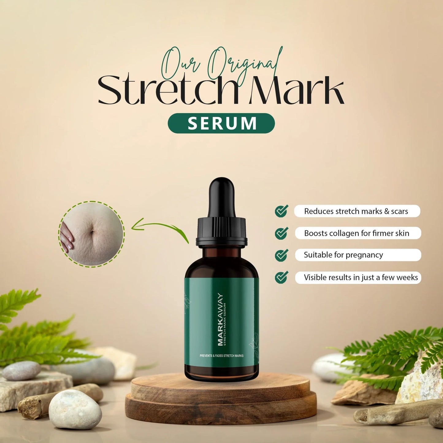 Markaway Stretch Mark Serum – Fade Marks, Boost Confidence